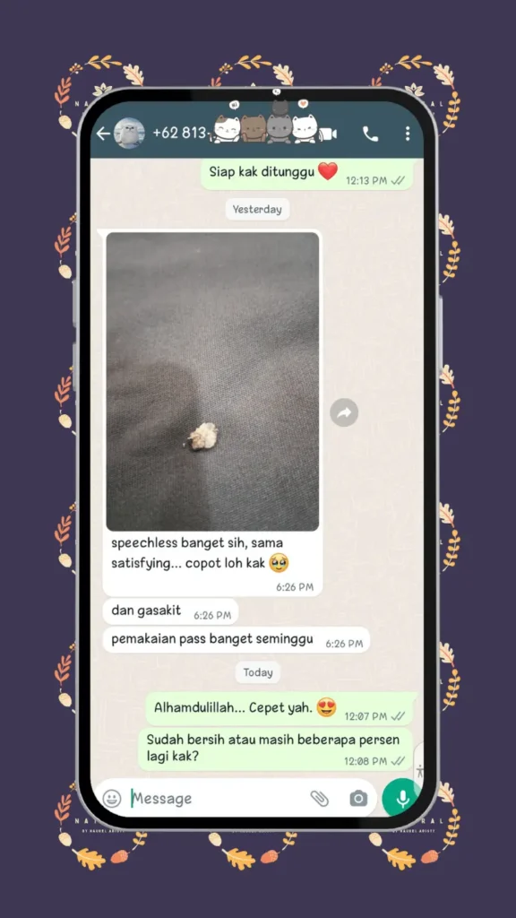 testimoni obat kutil kelamin
